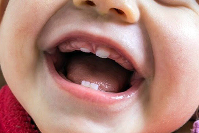 Saúde Bucal Infantil - A Saúde Começa pela Boca